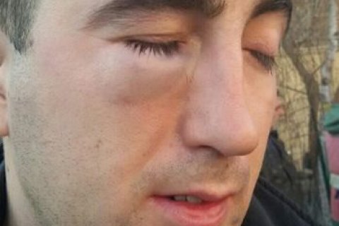 Співробітник дарницького "зеленбуду", колишній військовий, звинувачує старого чиновника у нападі