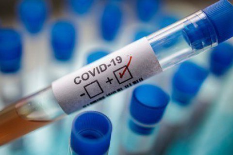 Число жертв коронавірусу в світі перевищило 315,2 тис. осіб
