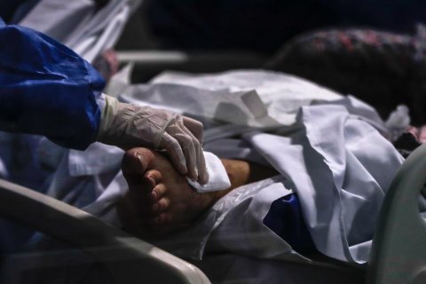 В киевской больнице умер один из шести пациентов, у которого подтвердили COVID штамма дельта
