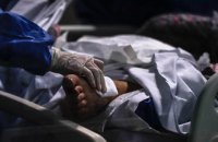 В киевской больнице умер один из шести пациентов, у которого подтвердили COVID штамма дельта