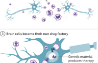 Лікарям уперше вдалося досягнути успіху в лікуванні руйнівної хворобі Ганітнгтона