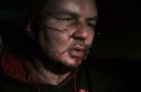 Похитители распяли лидера "Автомайдана" Дмитрия Булатова и отрезали ему ухо
