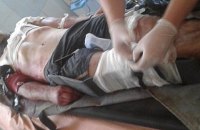 Медевак ПДМШ знову евакуював пораненого під Докучаєвськом