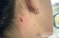 В Николаеве женщина получила ранение, выгуливая собак у полицейского стрельбища