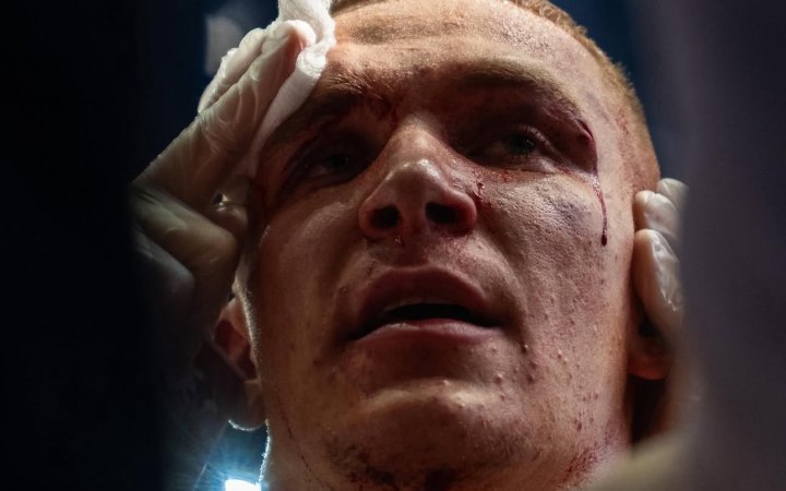 ​Лозан про поразку на Гран-прі WBC: "Не зміг навʼязати супернику свій бокс"