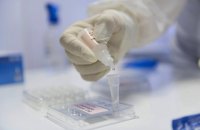 За сутки в Украине зафиксировано 13 276 новых случаев коронавируса