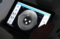 В Україні впроваджують цифрові технології для виявлення хронічних захворювань за допомогою ШІ, — МОЗ