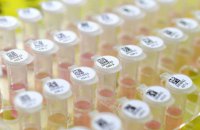 ВООЗ заперечує лабораторне походження коронавірусу