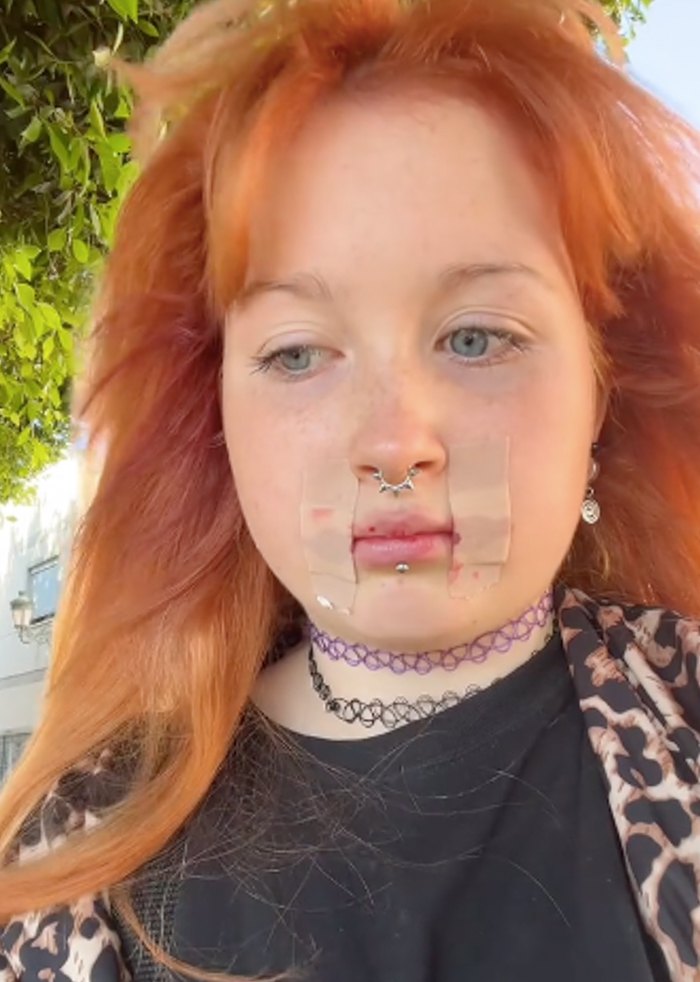 Дівчина на відео говорить, що скоріш за все пожалкує, що зробила надрізи.