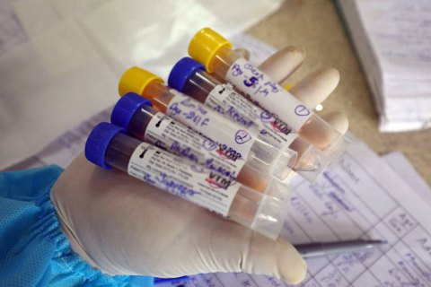 ​Словаччина пом’якшила умови пересування громадян із негативним тестом на коронавірус
