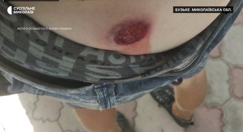 Слід від кулі в ухилянта в селі Бузьке