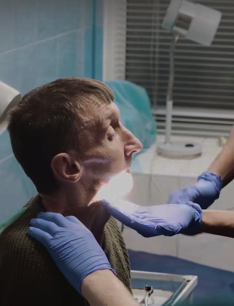 Огляд пацієнта перед операцією з реконструкції обличчя 