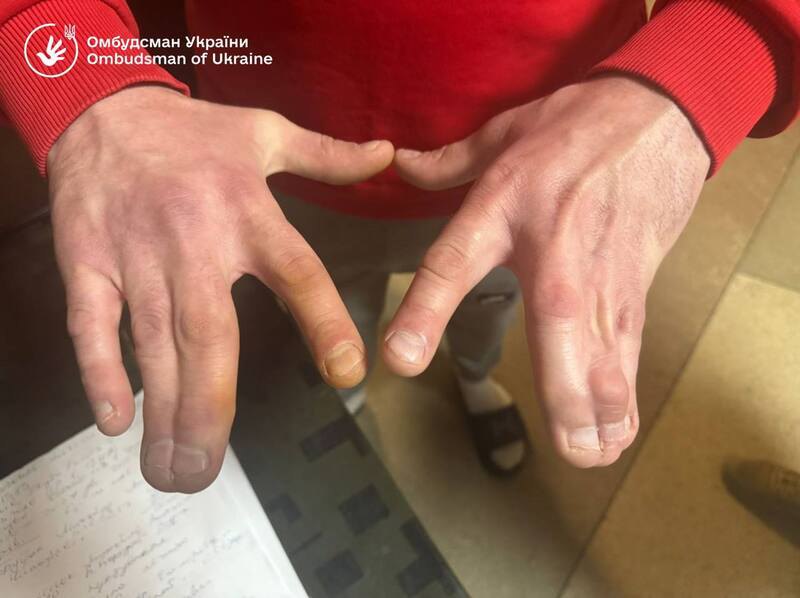 В Ужгородському РТЦК виявили незаконне утримання чоловіків та антисанітарні умови