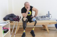 Обстеження людей з ампутаціями: що потрібно знати кожному медпрацівнику