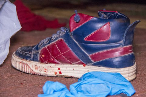 На вокзалі у Києві поїзд відрізав ногу іноземцю
