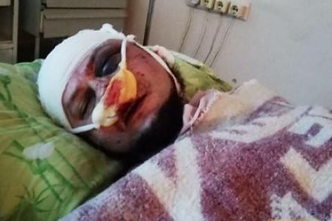 Активісту "Нацдружин", який боровся з наркорекламою в Павлограді, проломили голову