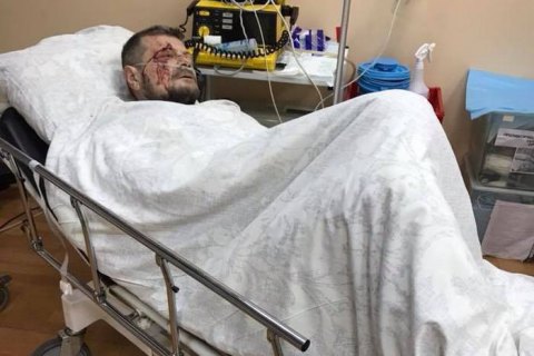 Мосийчук рассказал о состоянии здоровья после взрыва на Соломенке