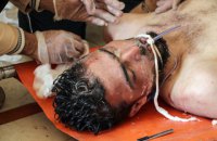 Кількість жертв хіматаки в Сирії зросла до 100