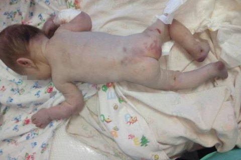 В первомайскую больницу подбросили избитого новорожденного