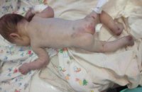 В первомайскую больницу подбросили избитого новорожденного