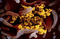 Ученые обнаружили более агрессивный подтип коронавируса