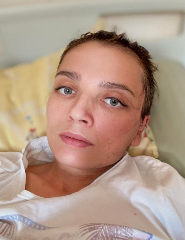 Вікторія через місяць після ракетної атаки на Охматдит, 8 серпня 2024 року