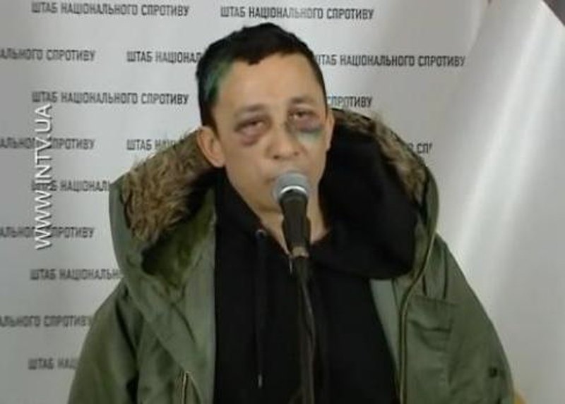 Побитий беркутівцями Олег Собченко під час пресконференції.