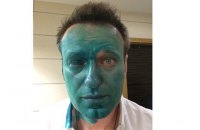 Навальному хлюпнули зеленкою в обличчя. Йому викликали "швидку" (оновлено)