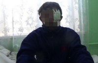 Узятий у полон бойовик заявив, що командування "ДНР" наказало взяти Авдіївський промзону