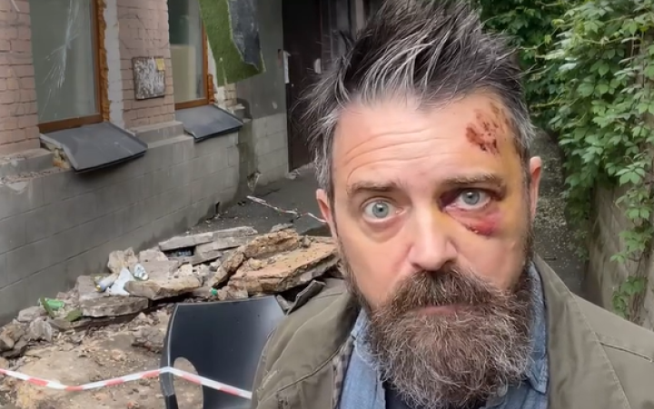 У Києві обвалився балкон, на якому стояв документаліст зі США Крістофер Волтерс