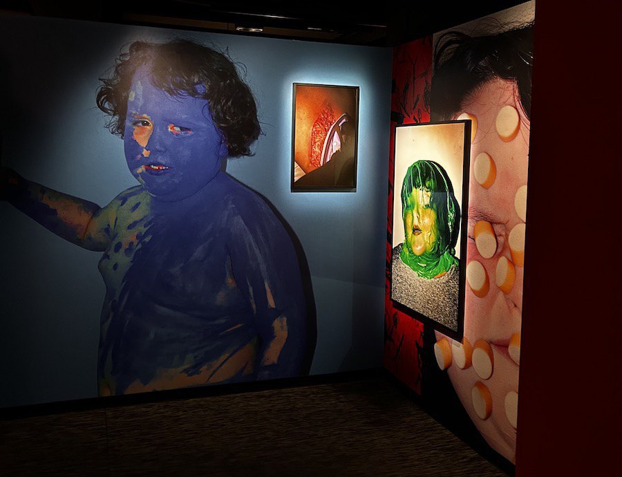 «We can't live without each other», Кароліна Войтас