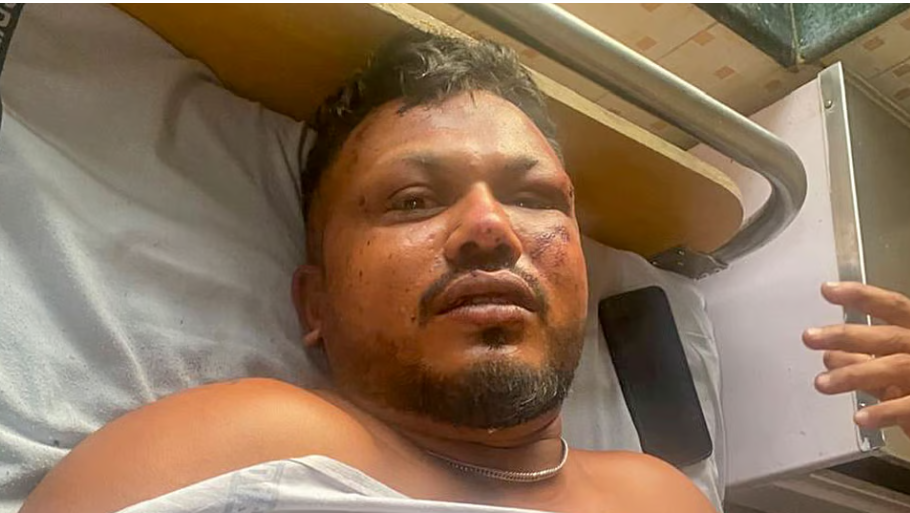 Британець Вішвашкумар Рамеш став єдиним пасажир, який вижив у авіакатастрофі в Індії