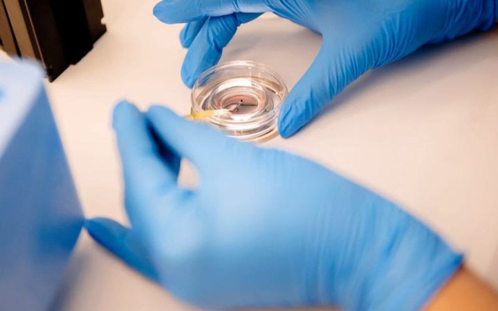 Уряд хоче заборонити донацію власних ембріонів чужим людям для вагітності – лікарі проти, МОЗ каже про ризики торгівлі дітьми