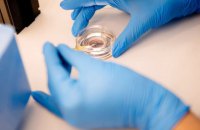 Уряд хоче заборонити донацію власних ембріонів чужим людям для вагітності – лікарі проти, МОЗ каже про ризики торгівлі дітьми