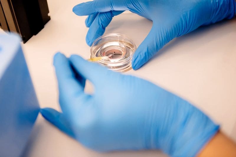 Екстракорпоральне запліднення (ЕКЗ) 