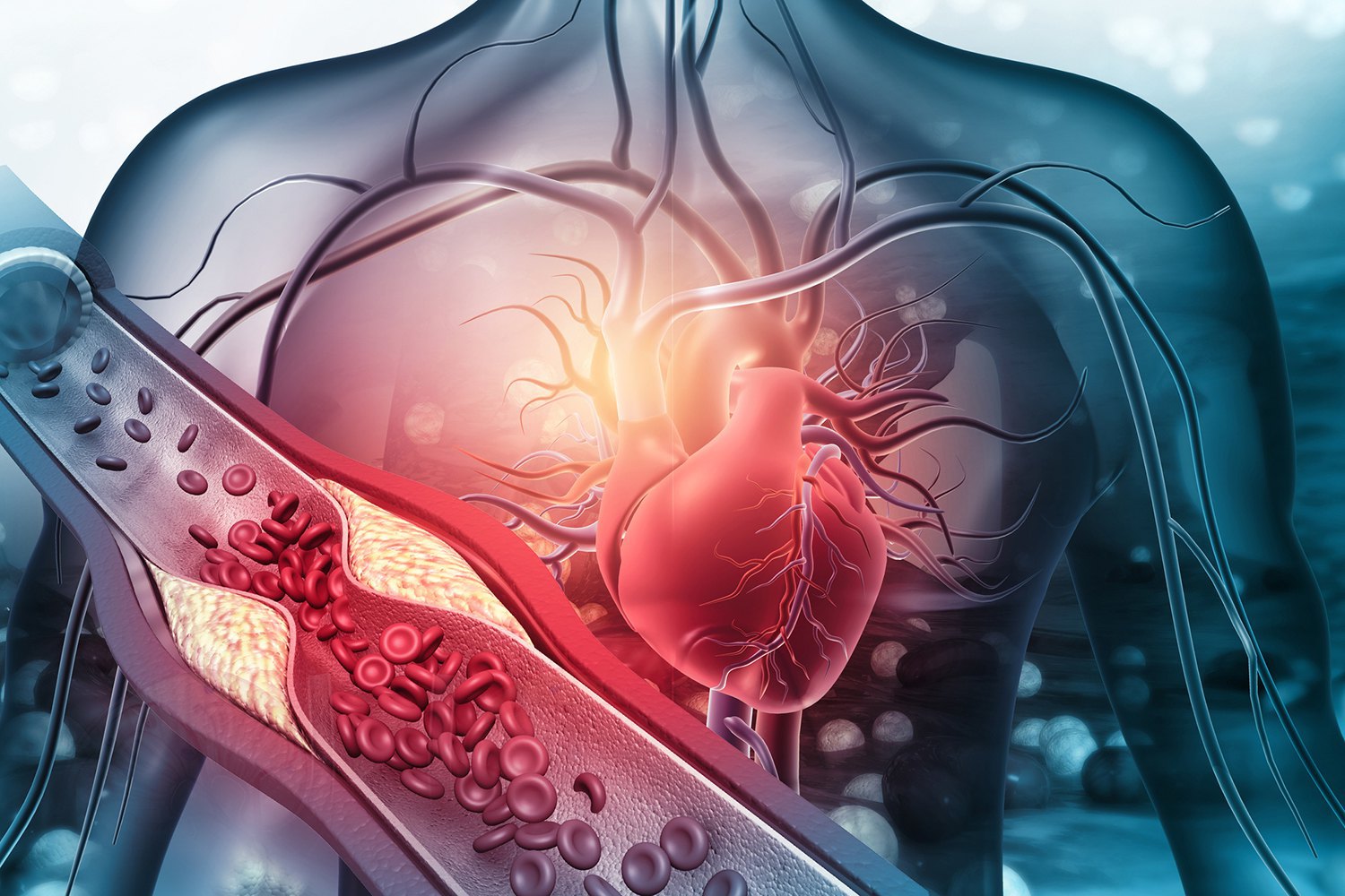 Кардіометаболічні захворювання. Їхня суть криється в самій назві