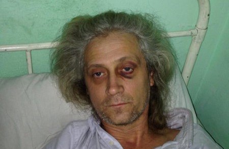 Валерий Гарагуц после избиения