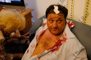 Єфремов: б'ютівця ніхто не бив, він оступився