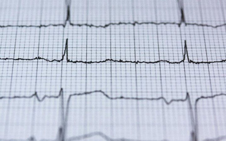 НСЗУ знайшла порушення в 11 лікарнях, які надають допомогу при інфарктах 