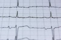 НСЗУ знайшла порушення в 11 лікарнях, які надають допомогу при інфарктах 