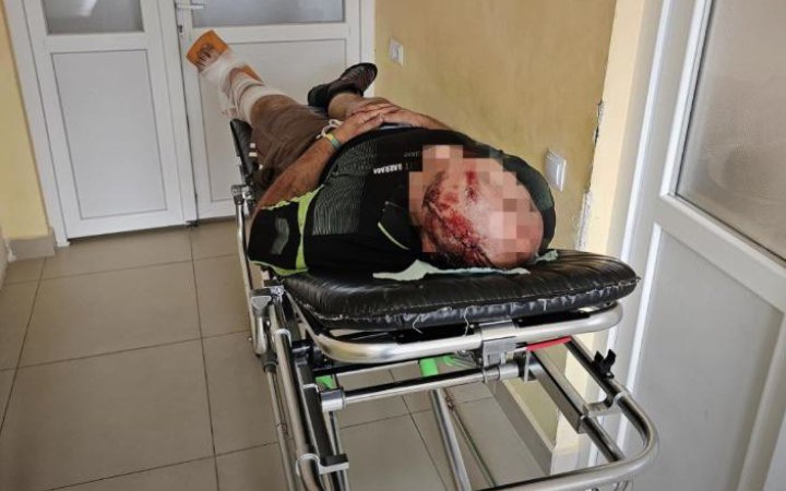 Чоловік зламав ногу при спробі втекти з України, вистрибнувши з поїзда