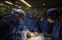 У США вперше успішно пересадили людині нирку, вирощену в тілі свині