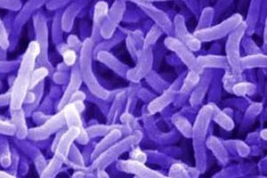В Мариуполе зафиксировали 23-й случай холеры