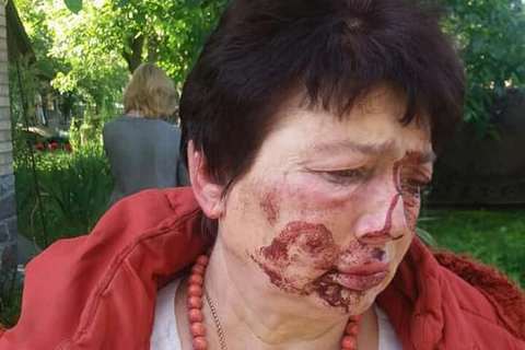 В Коцюбинском избили главу теризбиркома