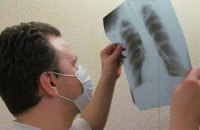 ВОЗ не относит Украину к числу стран с высокой заболеваемостью туберкулезом