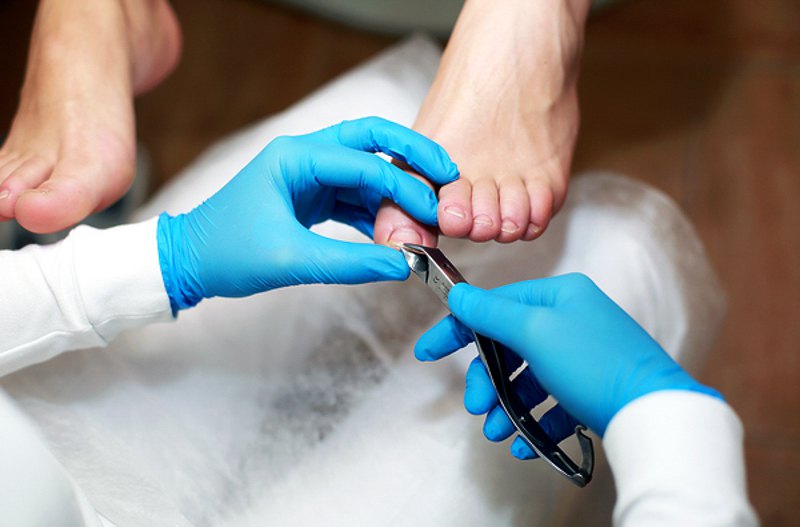 Для підрізання нігтів найкраще придбати професійні кусачки для нігтів.