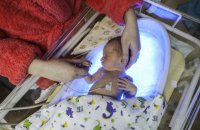 Передчасно народжені діти: як працює Програма медичних гарантій