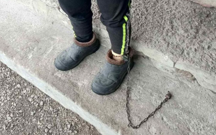 На Кіровоградщині закрили дитячий будинок сімейного типу, де дитину з синдромом Дауна тримали на ланцюзі