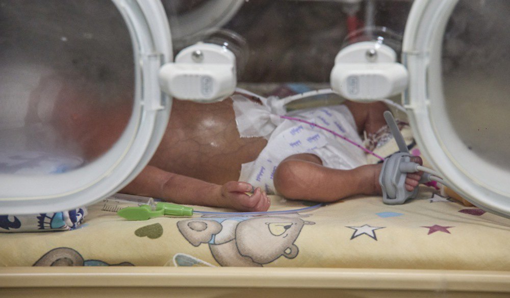 Недоношене немовля в перинатальному центрі в Харкові, 12 грудня 2022 р.