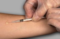 Манту – в минулому: в Україні впроваджують нові методи діагностики туберкульозу